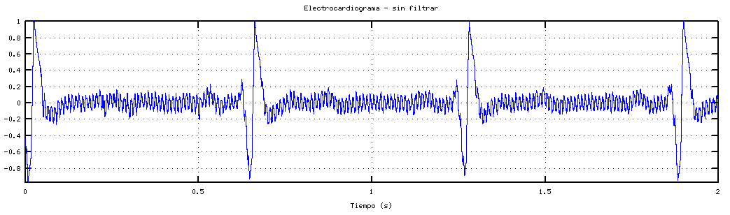 electrocardiograma