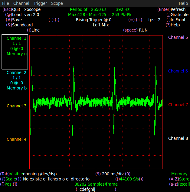 electrocardiograma