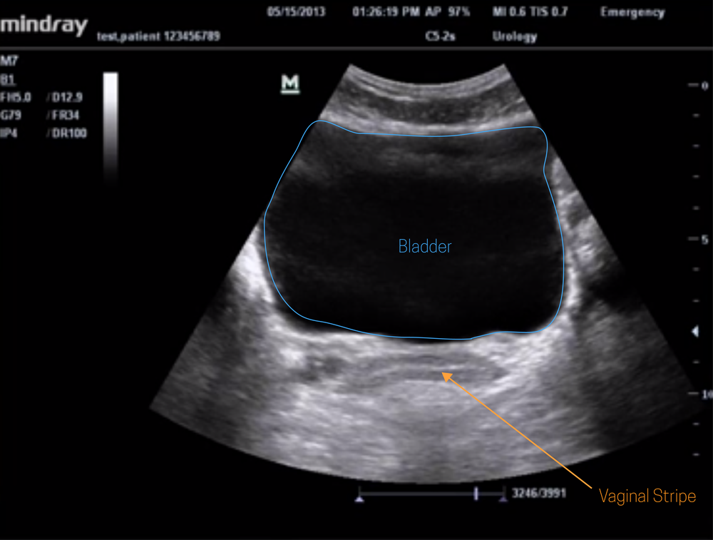 hepatobiliary ultrasound